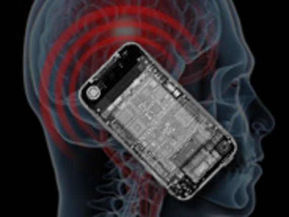 The mobile phone of the future will be implanted in your head